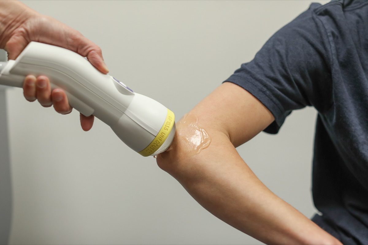 Elbow being treated with shockwave therapy