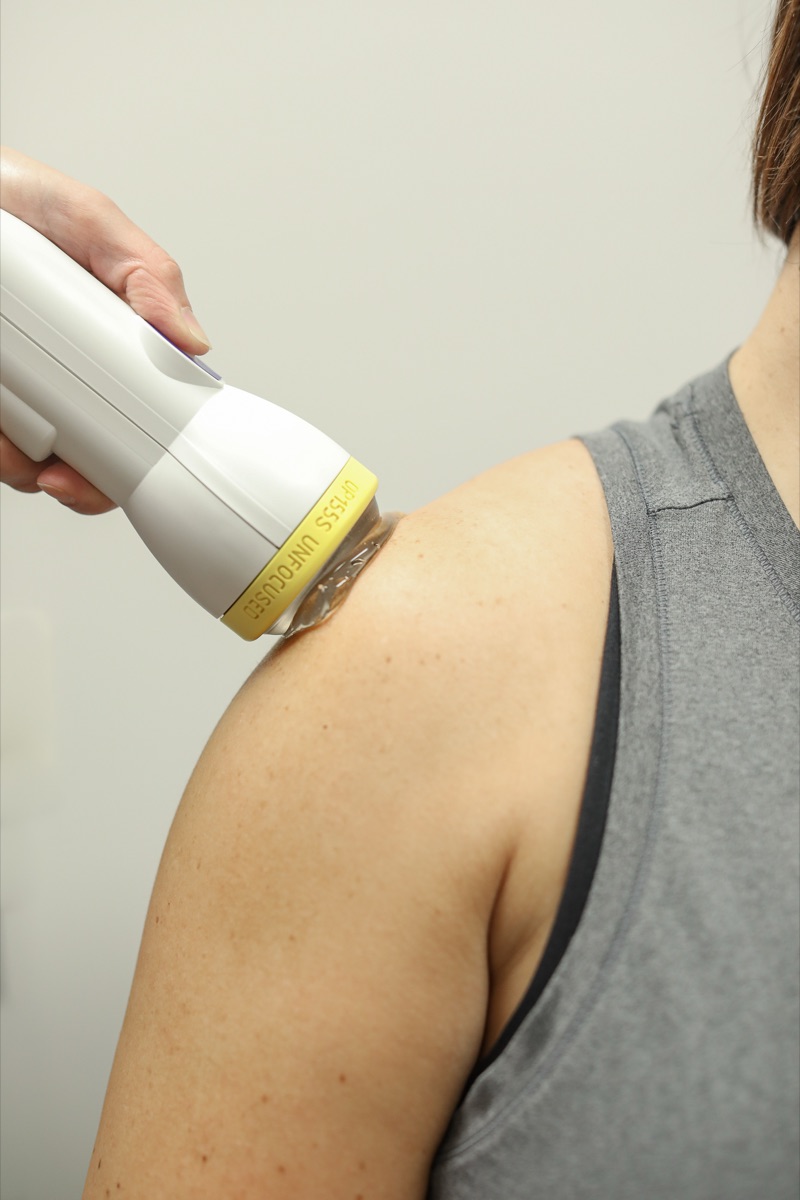 Shoulder being treated with shockwave therapy